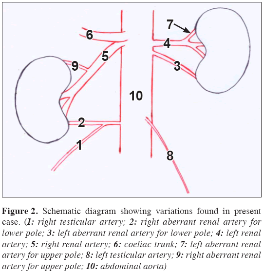 Abdominal Aorta Artery Branches