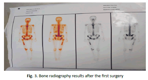 JOTSRR-Bone