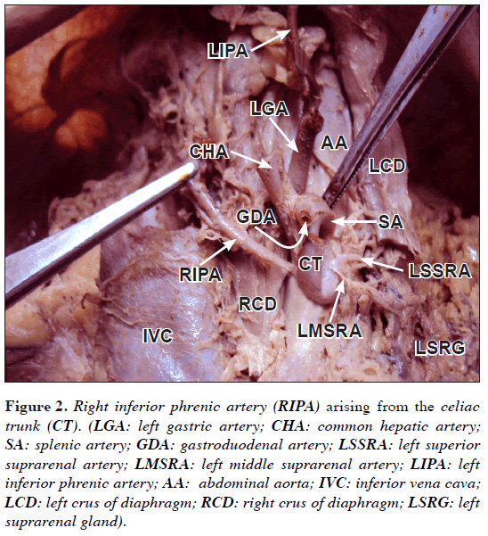 Celiac Trunk Abdominal Aorta Branches