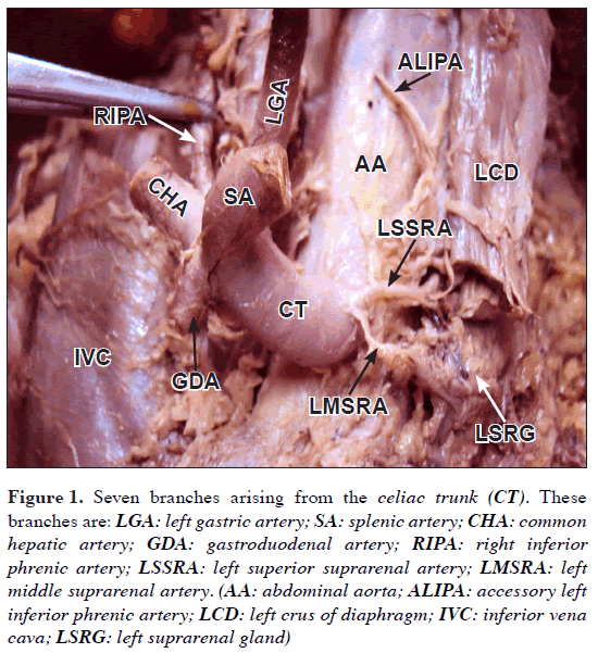 Uncommon Branching Pattern Of The Celiac Trunk Origin Of Seven