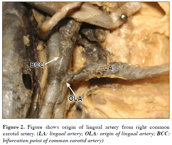 lingual artery
