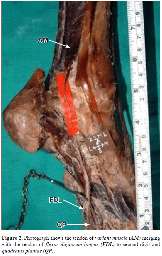rare variation of flexor digitorum longus muscle of leg a case report