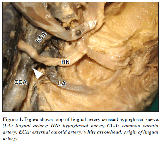 lingual artery