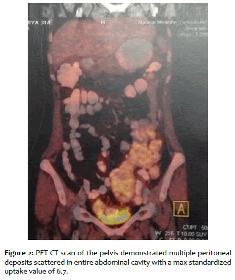 clinical-reproductive-entire-abdominal