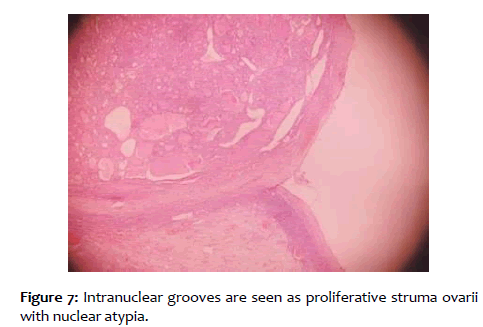 clinical-reproductive-nuclear-atypia