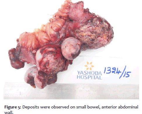 clinical-reproductive-small-bowel