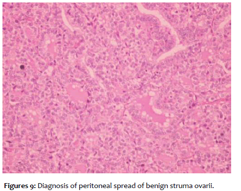 clinical-reproductive-thyroid-carcinoma