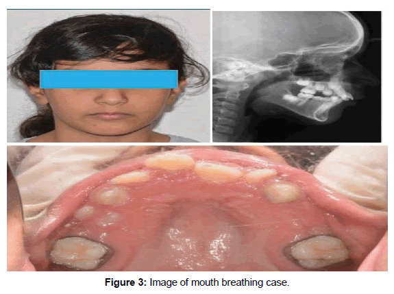 health-sciences-research-breathing-case