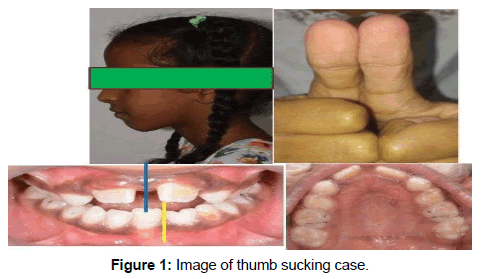 health-sciences-research-sucking-case