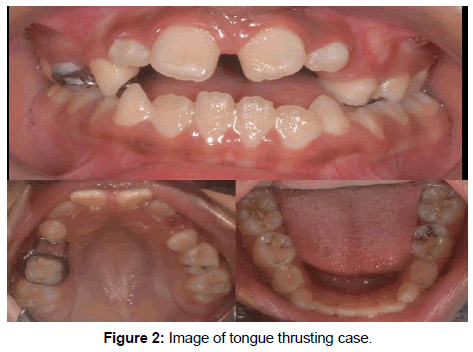 health-sciences-research-thrusting-case