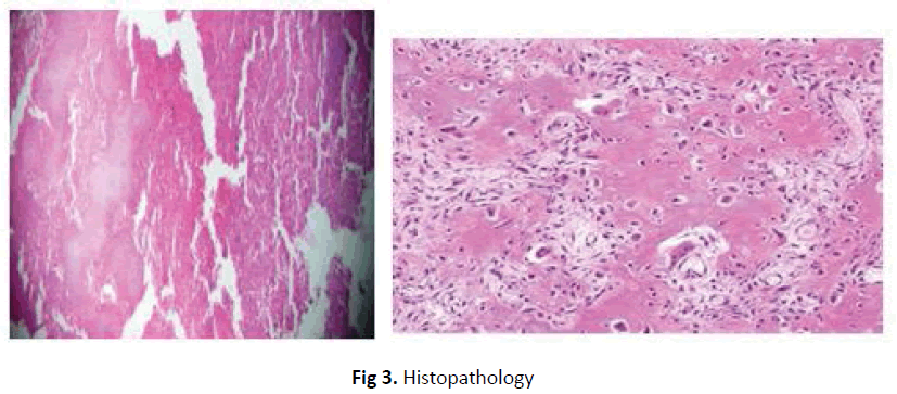 JOTSRR-Histopathology