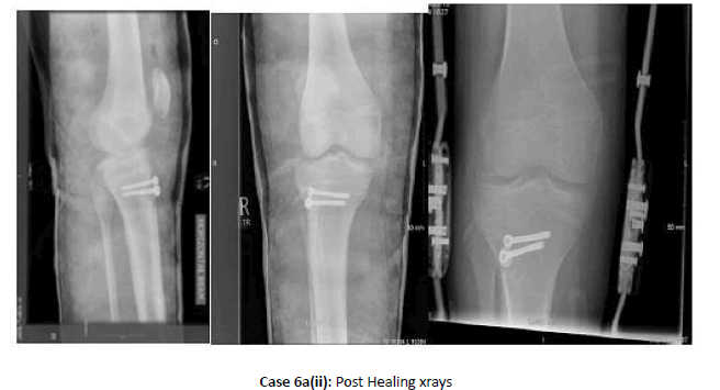 Orthopaedics-Trauma-Healing