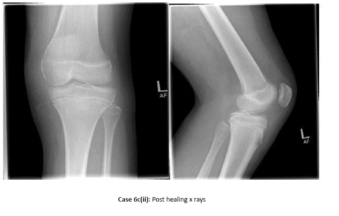 Orthopaedics-Trauma-Post