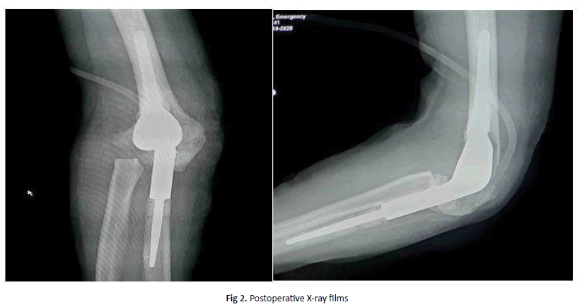 Orthopaedics-Trauma-Postoperative