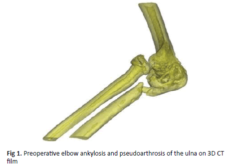 Orthopaedics-Trauma-Preoperative