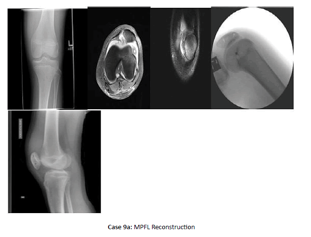 Orthopaedics-Trauma-Reconstruction