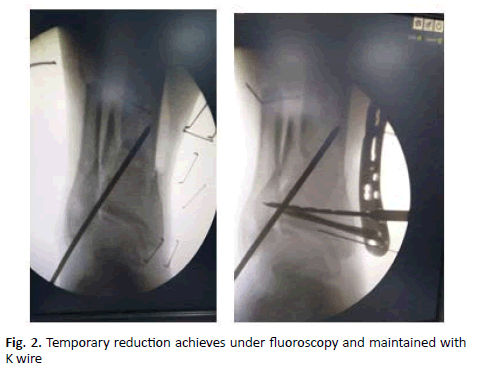 Orthopaedics-Trauma-achieves