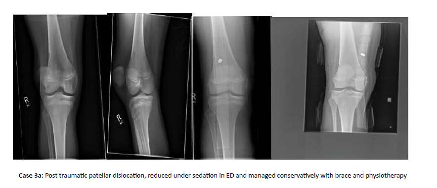 Orthopaedics-Trauma-dislocation