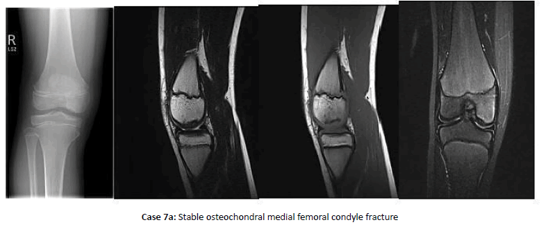 Orthopaedics-Trauma-femoral