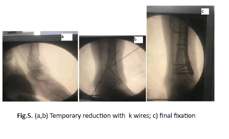 Orthopaedics-Trauma-fixation