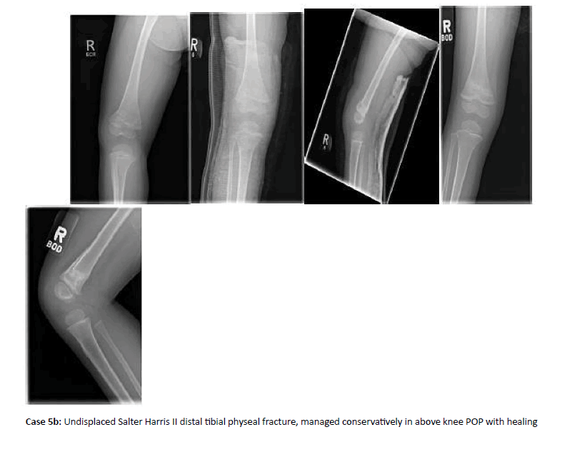 Orthopaedics-Trauma-fracture