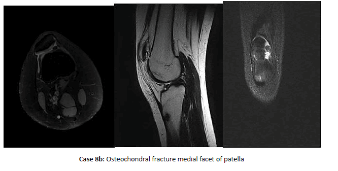 Orthopaedics-Trauma-fracturel