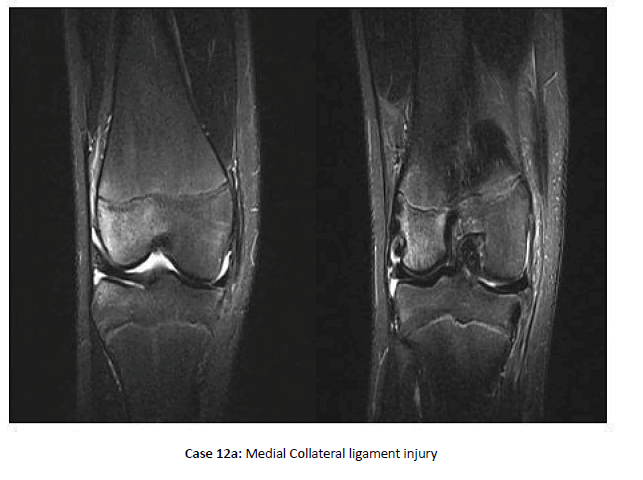 Orthopaedics-Trauma-injury