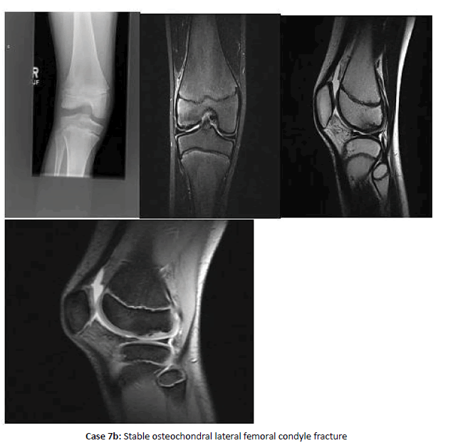 Orthopaedics-Trauma-lateral