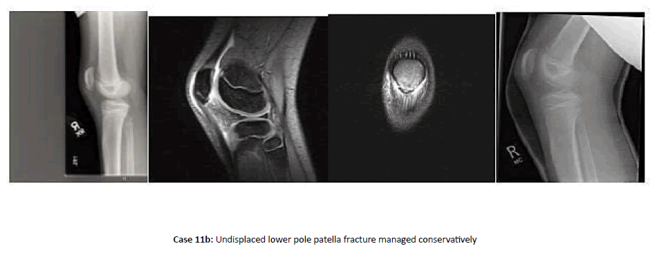 Orthopaedics-Trauma-lower