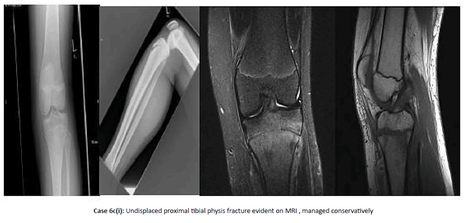 Orthopaedics-Trauma-managed