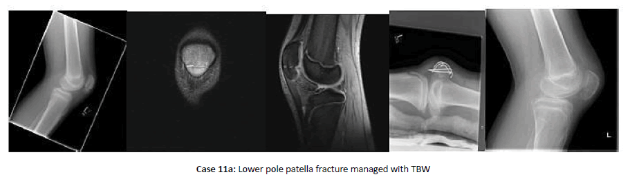 Orthopaedics-Trauma-managed