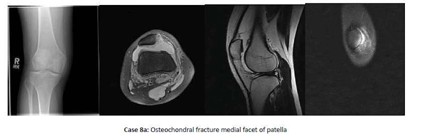 Orthopaedics-Trauma-patellal