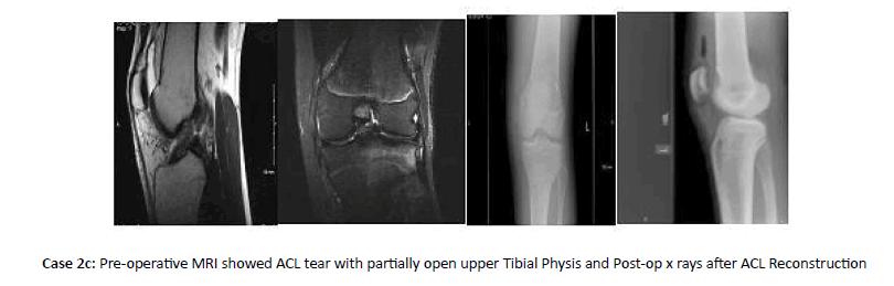 Orthopaedics-Trauma-rays