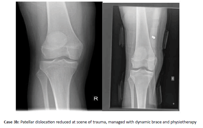 Orthopaedics-Trauma-scene