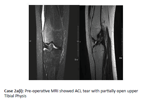 Orthopaedics-Trauma-showed