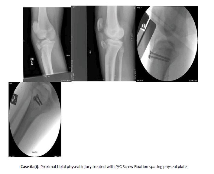 Orthopaedics-Trauma-sparing