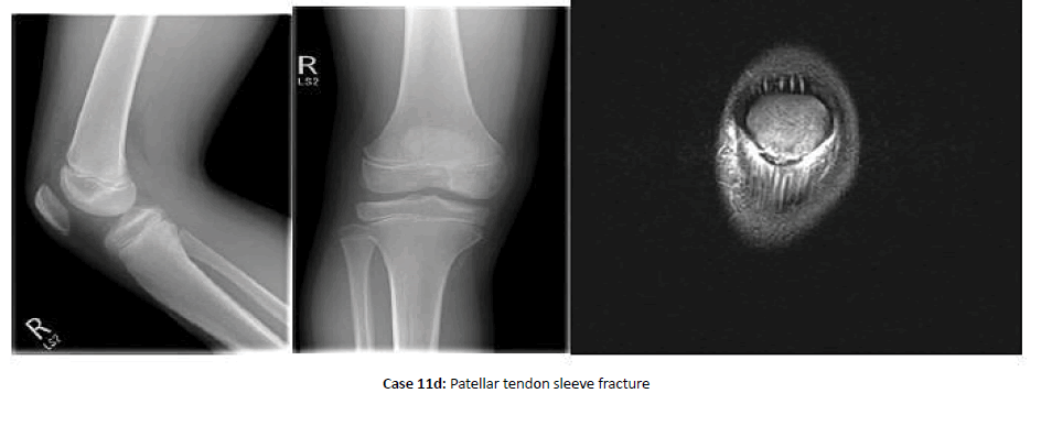 Orthopaedics-Trauma-tendon