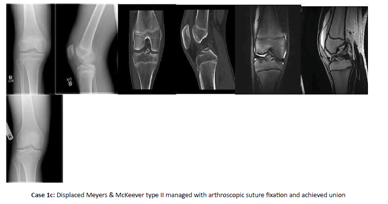 Orthopaedics-Trauma-union