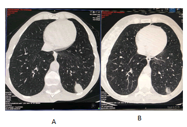 annals-medical-before