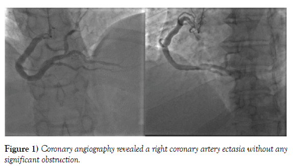clinical-cardiology-coronary-angiography