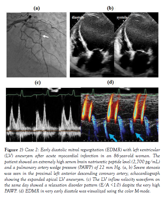 clinical-cardiology-journal-diastolic