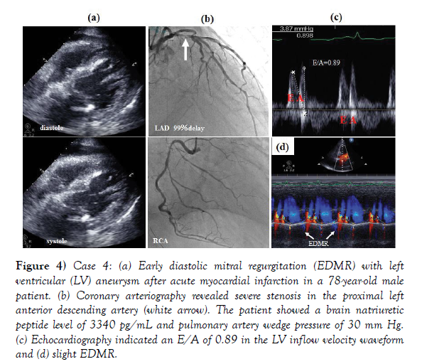 clinical-cardiology-journal-echocardiography