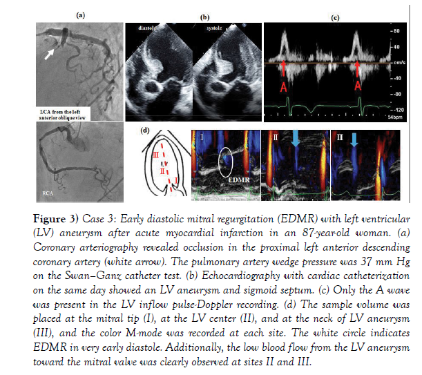 clinical-cardiology-journal-myocardial