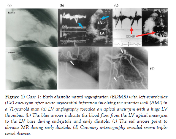 clinical-cardiology-journal-regurgitation