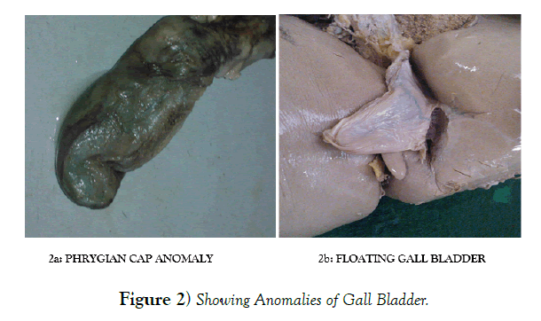 international-journal-anatomical-variations-Anomalies