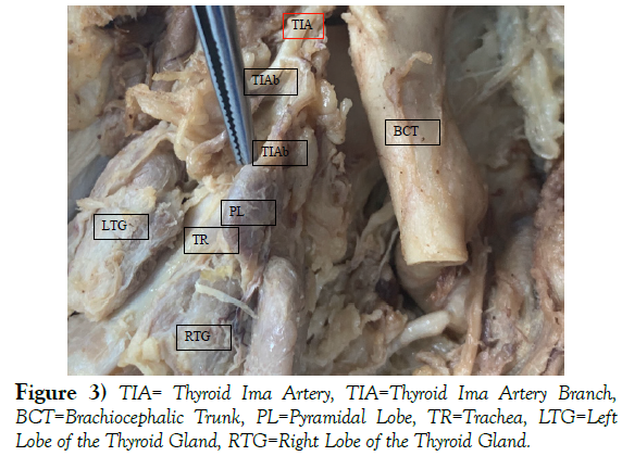international-journal-anatomical-variations-Artery