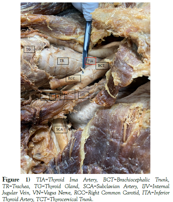 international-journal-anatomical-variations-Brachiocephalic