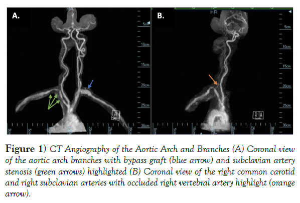 international-journal-anatomical-variations-Branches