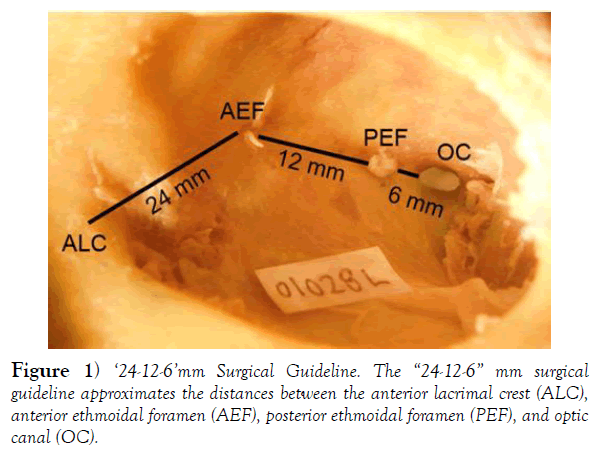 international-journal-anatomical-variations-Guideline