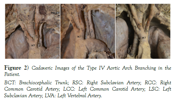 international-journal-anatomical-variations-Images